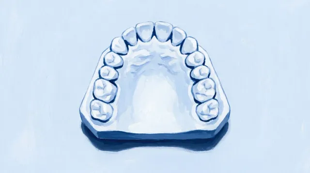 Un modelo de arcada completa visto desde arriba, con todos sus dientes
