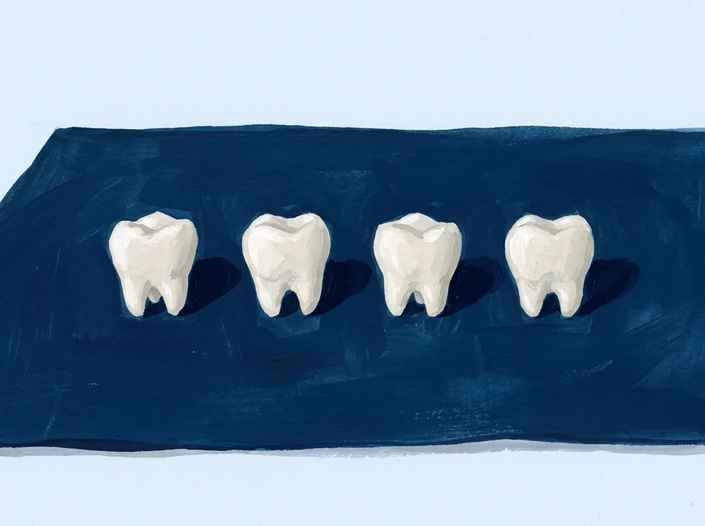 Cuatro dientes de leche alineados en fila sobre un paño