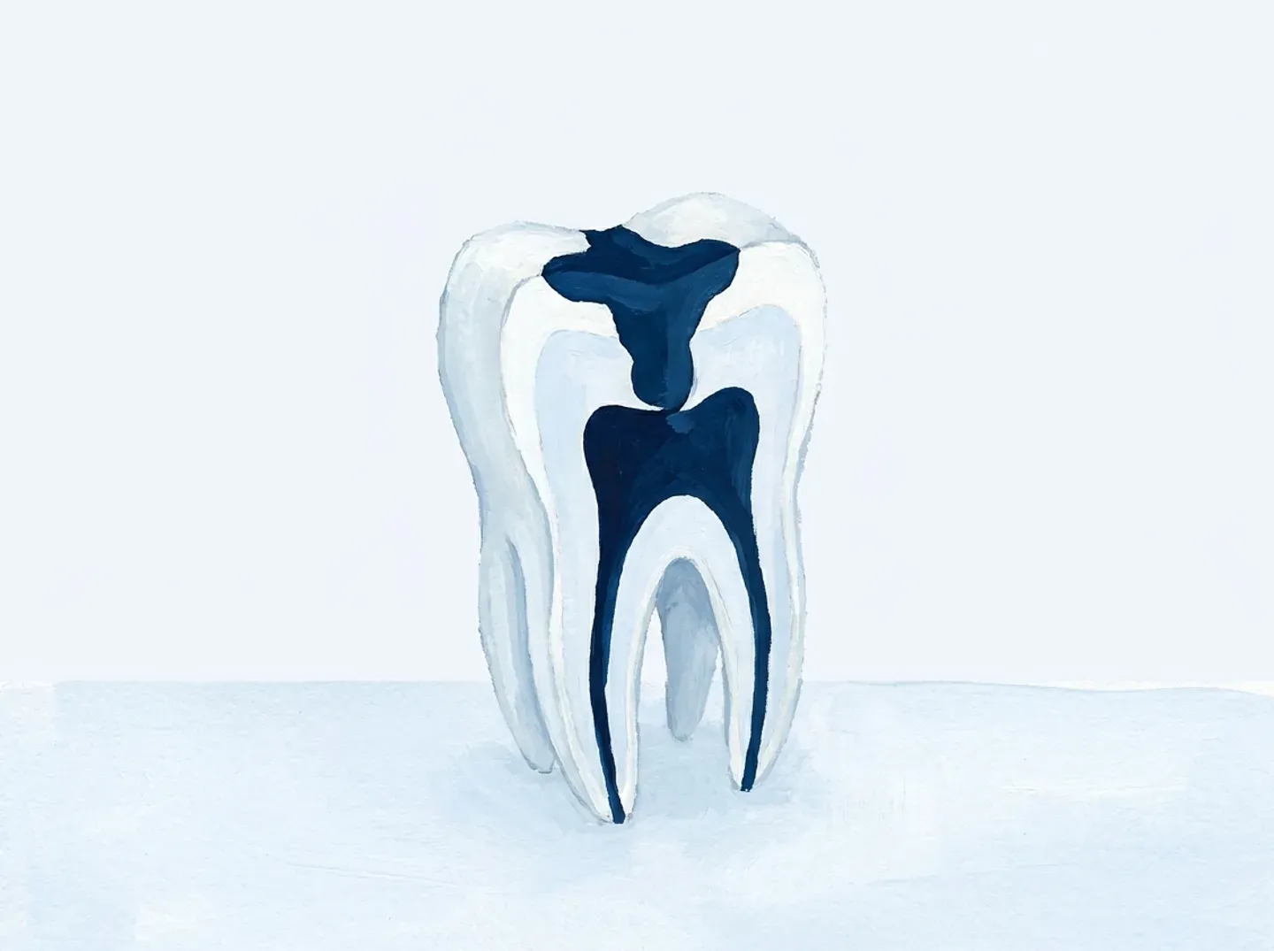 Un molar cortado por la mitad: el fondo del empaste queda a un pelo de la cámara