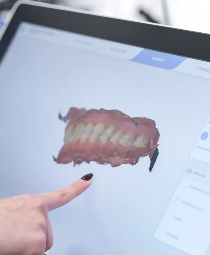Una profesional señala en la pantalla el modelo en 3D de una dentadura