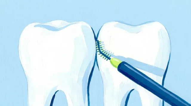 Un cepillo interdental entrando en el espacio entre dos dientes