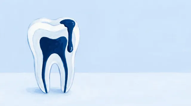 Una gota resbalando por fuera de un molar cortado, sin llegar a la cámara de dentro