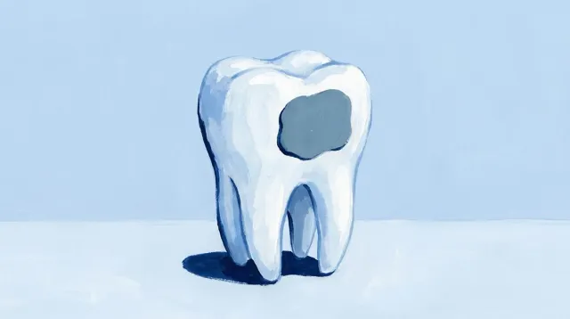 Un molar con una mancha mate en su cara, todavía sin agujero