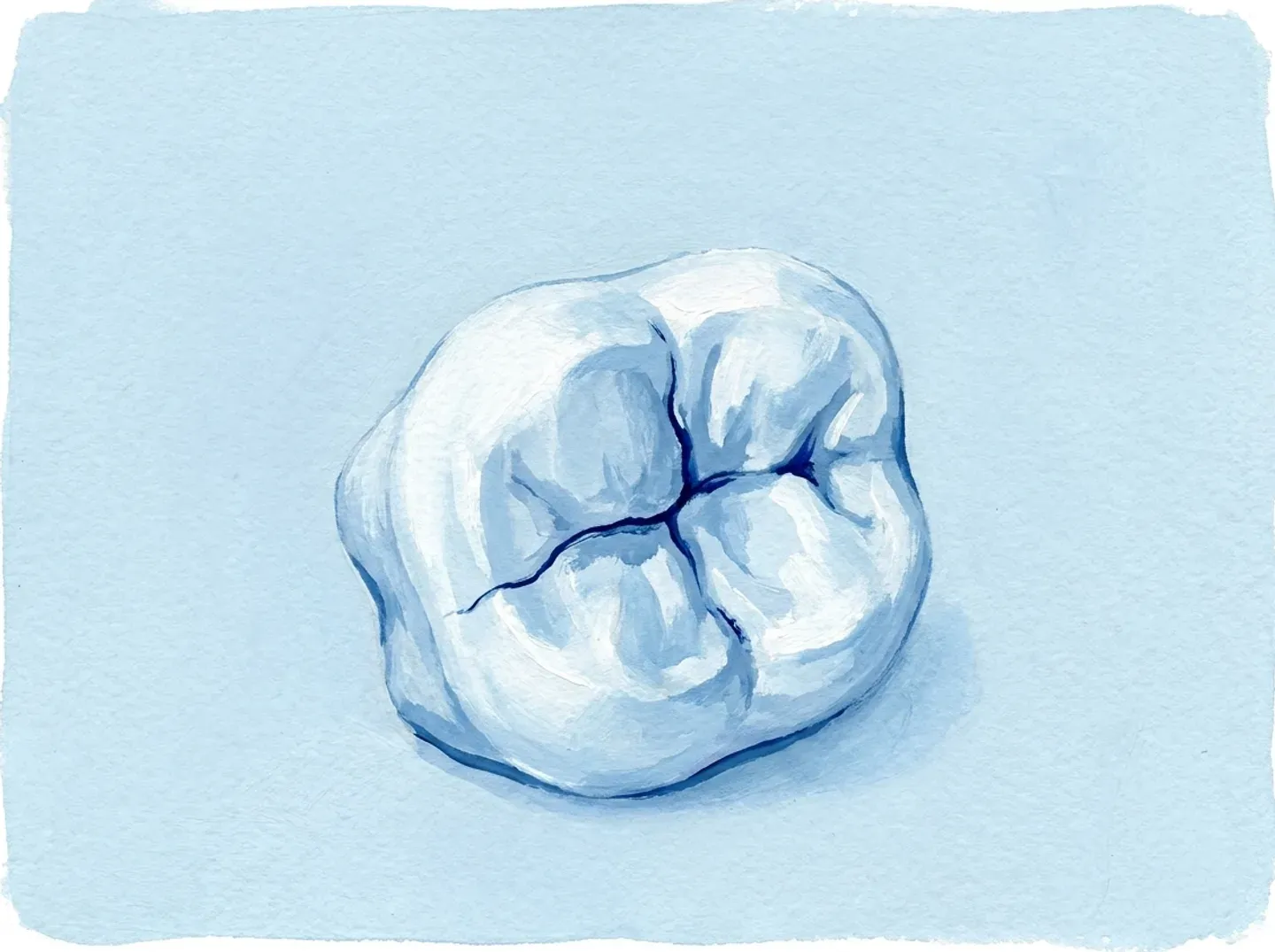 La cara de masticar de un molar, con una fisura que la cruza de lado a lado