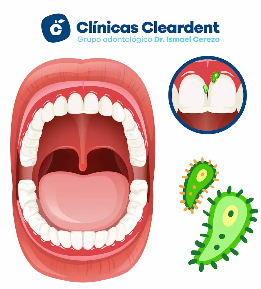 Bacterias en la boca  Cleardent 