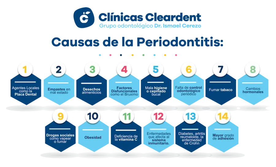 Casusas de la Periodontitis Cleardent