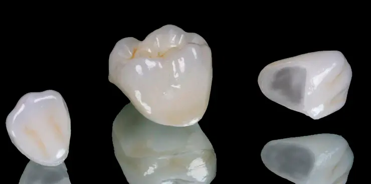 disilicato de litio coronas