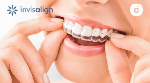 invisalign