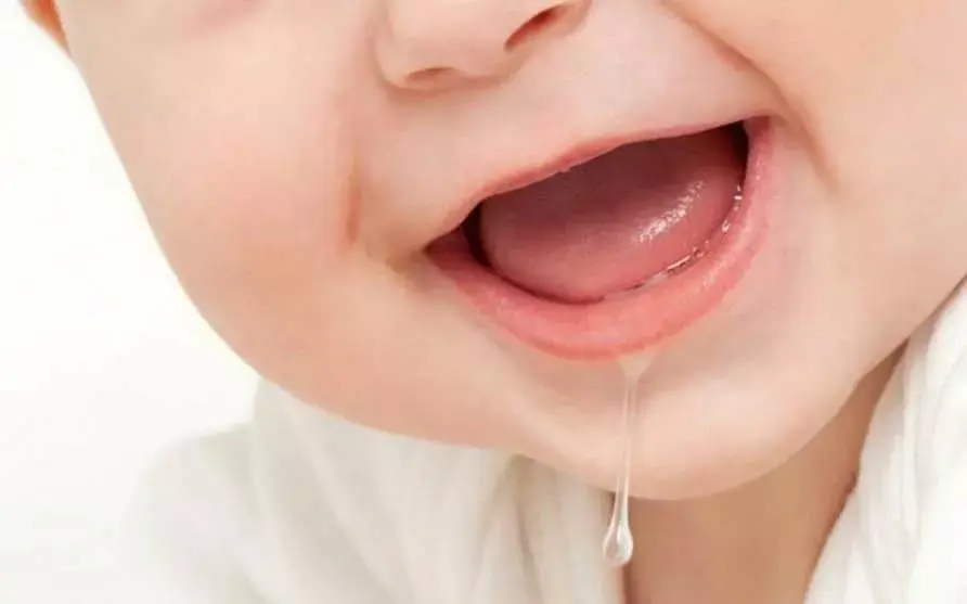 sialorrea foto bebe Cleardent