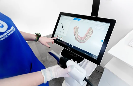 escaner dental 3d