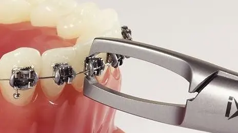 como quitar los brackets