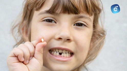 Caída de los dientes de leche