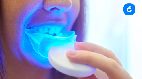 blanquear dientes en casa