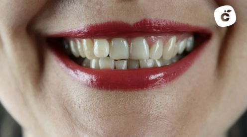 Hipoplasia dental