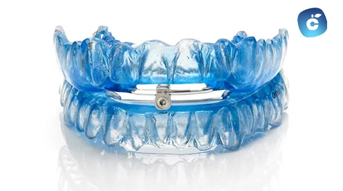 aparatos dentales para apnea