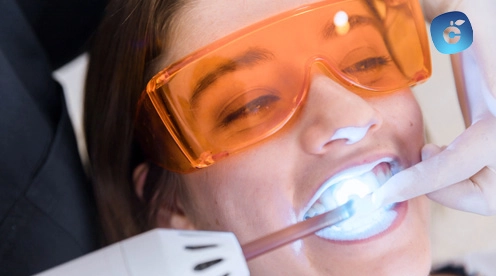 cuánto vale blanqueamiento dental