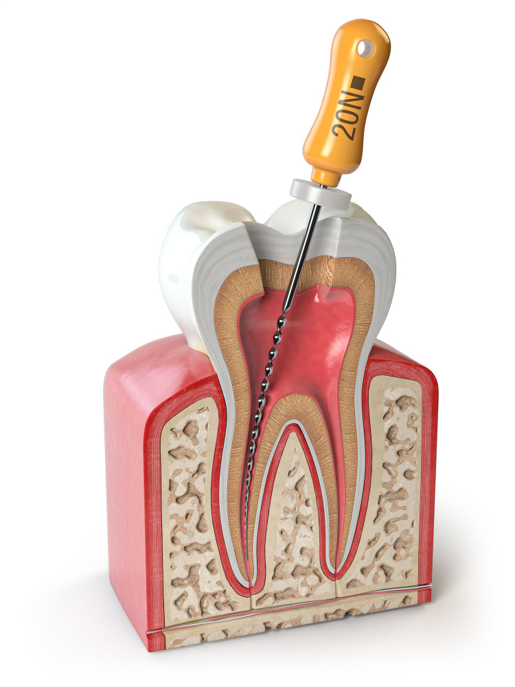 Endodoncia