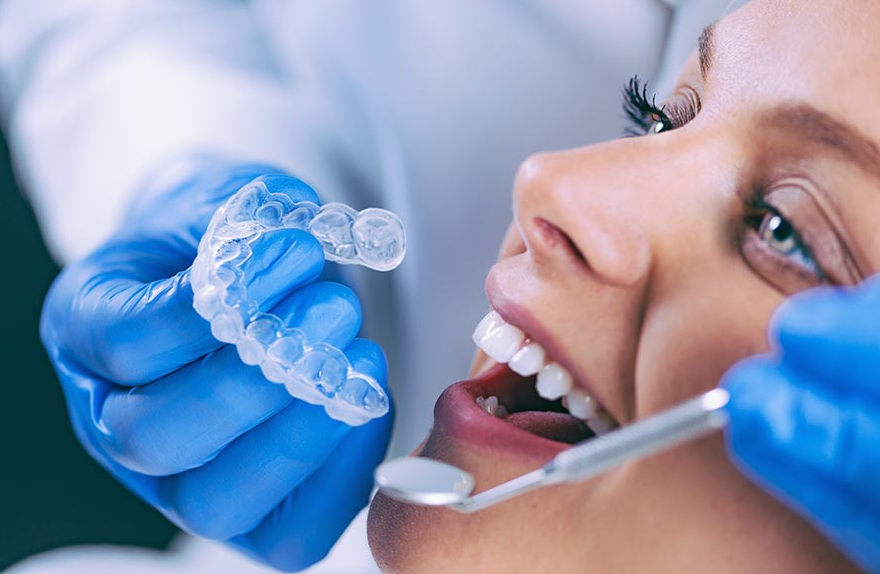 blanqueamiento dental ferulas