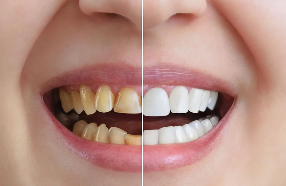 estetica dentales