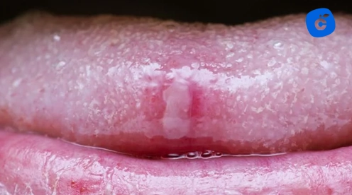 grano blanco lengua