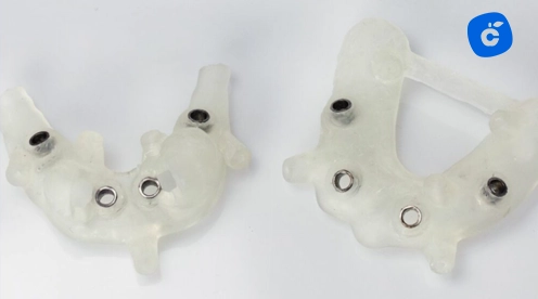 implante dental sin tornillo