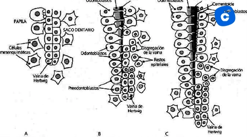 vaina radicular