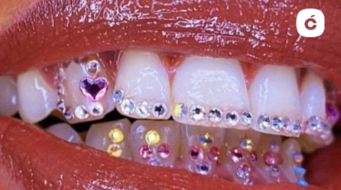 tooth gem