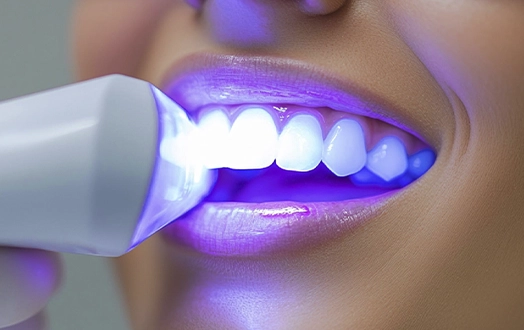 blanquemientos naturales