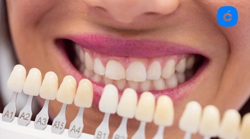 composite vs porcelana