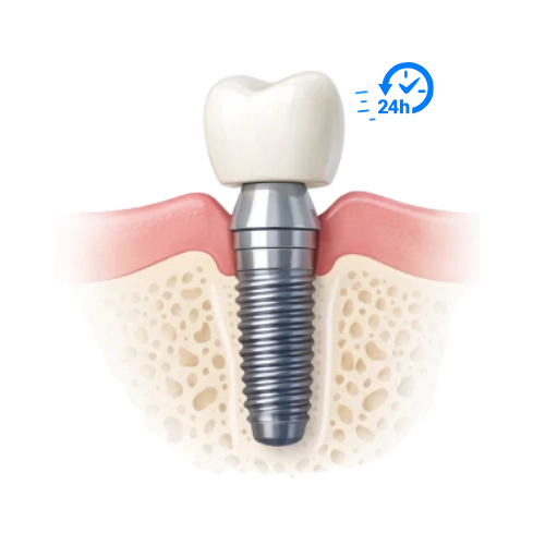 carga inmediata implante en 1 dia