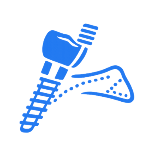 implantes pterigoideos