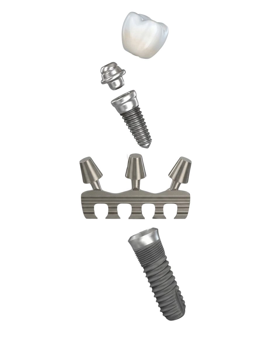 tipos de implantes endooseos