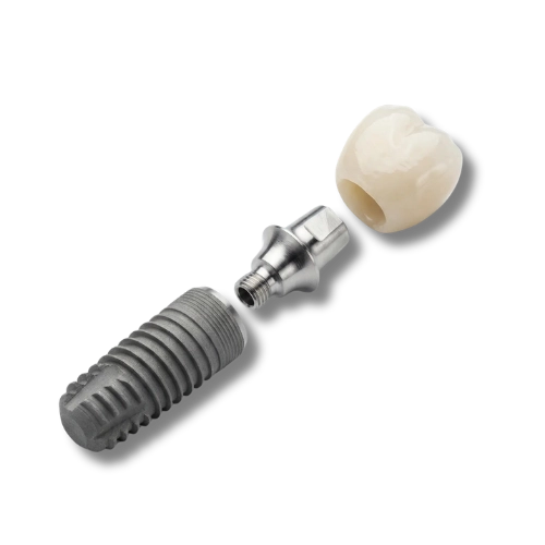 un implante dental que es